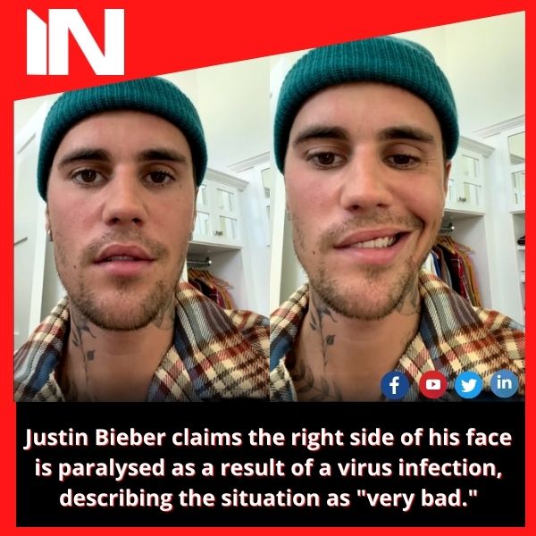 Justin Bieber claims the right side of his face is paralysed as a result of a virus infection, describing the situation as “very bad.”