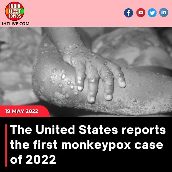 The United States reports the first monkeypox case of 2022
