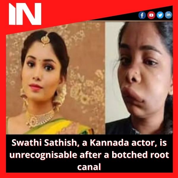 Swathi Sathish, a Kannada actor, is unrecognisable after a botched root canal